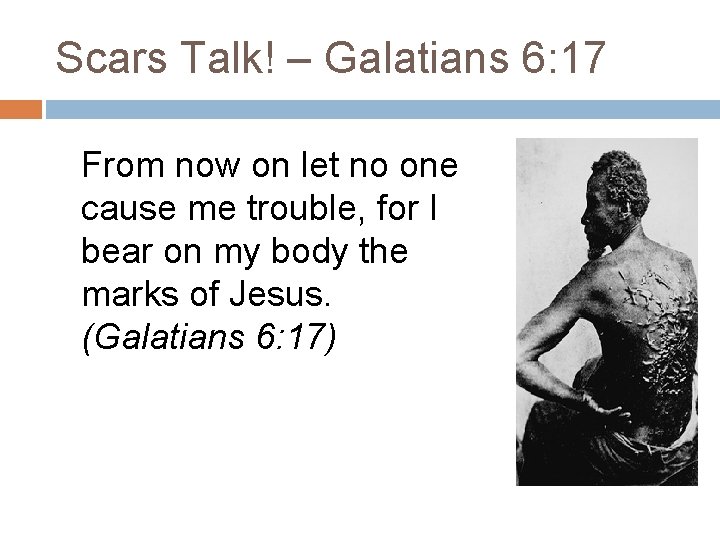 Scars Talk! – Galatians 6: 17 From now on let no one cause me Scars Talk! – Galatians 6: 17 From now on let no one cause me