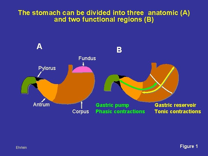 The stomach can be divided into three anatomic (A) and two functional regions (B)