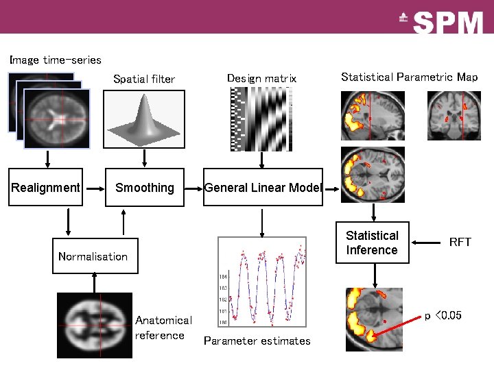 Image time-series Realignment Spatial filter Design matrix Smoothing General Linear Model Statistical Parametric Map
