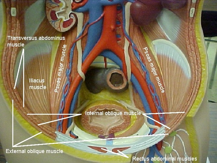 le usc Psoas rm Iliacus muscle ajo major m m as Pso uscle Transversus