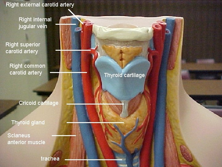 Right external carotid artery Right internal jugular vein Right superior carotid artery Right common