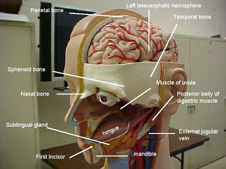 Left telecenphalic hemisphere Parietal bone Temporal bone Sphenoid bone Muscle of uvula Nasal bone