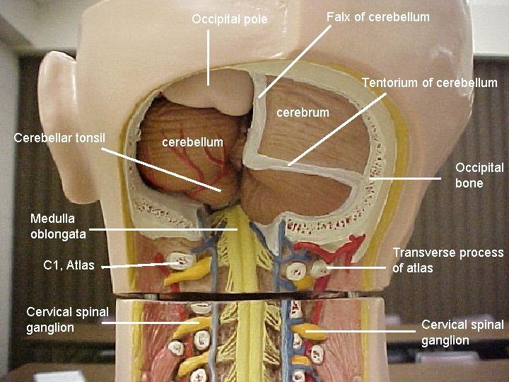 Occipital pole Falx of cerebellum Tentorium of cerebellum cerebrum Cerebellar tonsil cerebellum Occipital bone