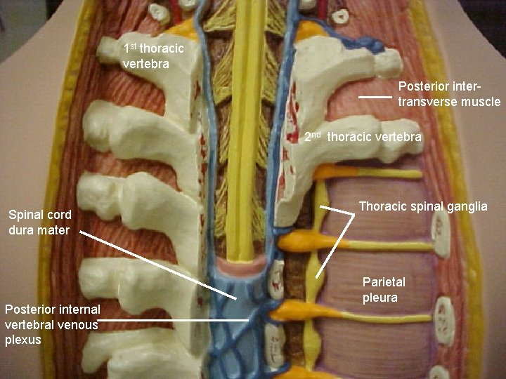 1 st thoracic vertebra Posterior intertransverse muscle 2 nd thoracic vertebra Spinal cord dura