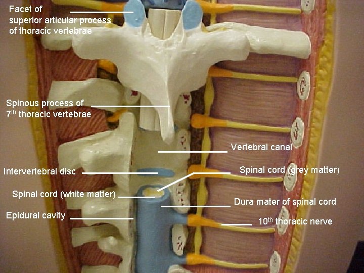 Facet of superior articular process of thoracic vertebrae Spinous process of 7 th thoracic