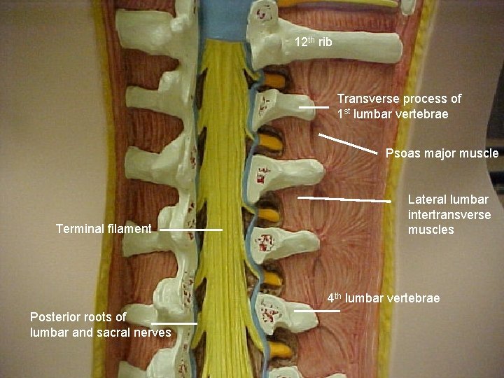12 th rib Transverse process of 1 st lumbar vertebrae Psoas major muscle Terminal