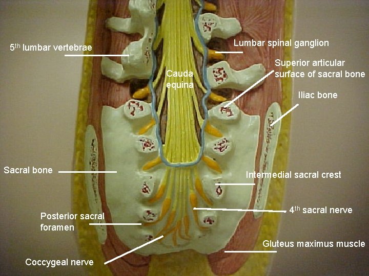 Lumbar spinal ganglion 5 th lumbar vertebrae Cauda equina Superior articular surface of sacral