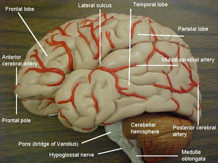 Frontal lobe Lateral sulcus Temporal lobe Parietal lobe Anterior cerebral artery Middle cerebral artery