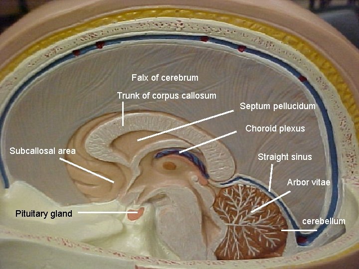 Falx of cerebrum Trunk of corpus callosum Septum pellucidum Choroid plexus Subcallosal area Straight