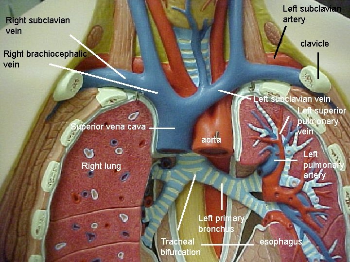 Left subclavian artery Right subclavian vein clavicle Right brachiocephalic vein Superior vena cava aorta