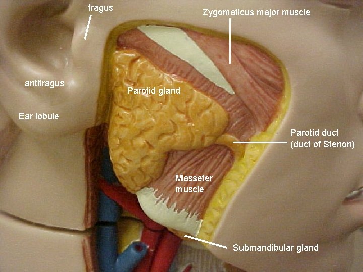 tragus antitragus Zygomaticus major muscle Parotid gland Ear lobule Parotid duct (duct of Stenon)