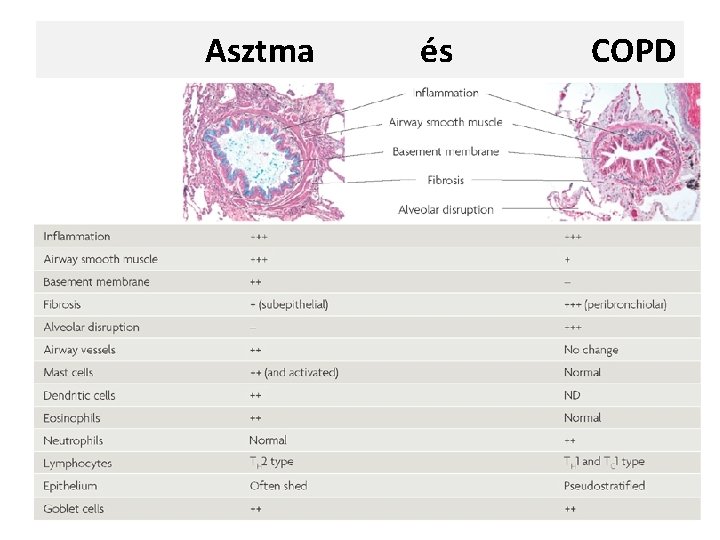 Asztma és COPD 