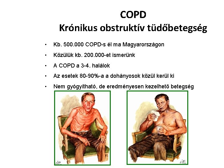 dohányzás és krónikus obstruktív tüdőbetegség)