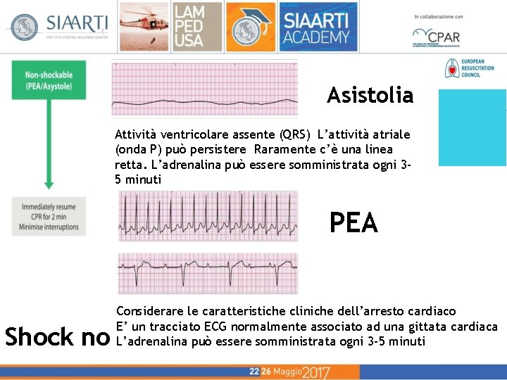 Asistolia Attività ventricolare assente (QRS) L’attività atriale (onda P) può persistere Raramente c’è una Asistolia Attività ventricolare assente (QRS) L’attività atriale (onda P) può persistere Raramente c’è una