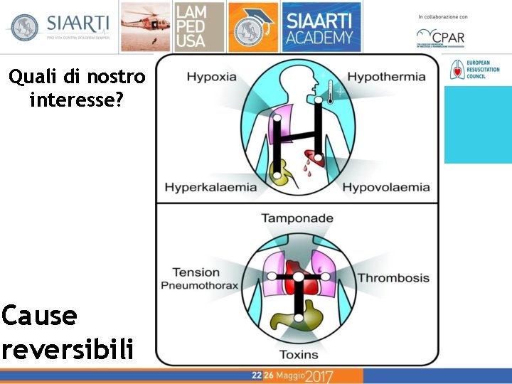 Quali di nostro interesse? Cause reversibili Quali di nostro interesse? Cause reversibili