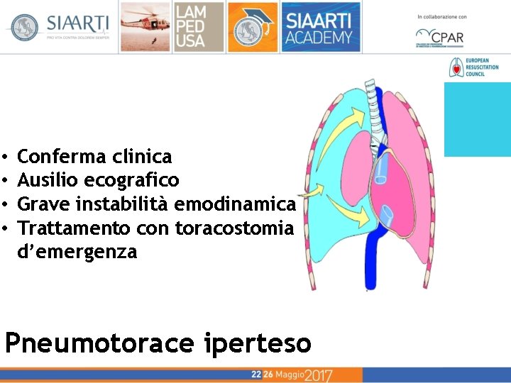 • Conferma clinica • Ausilio ecografico • Grave instabilità emodinamica • • Trattamento • Conferma clinica • Ausilio ecografico • Grave instabilità emodinamica • • Trattamento