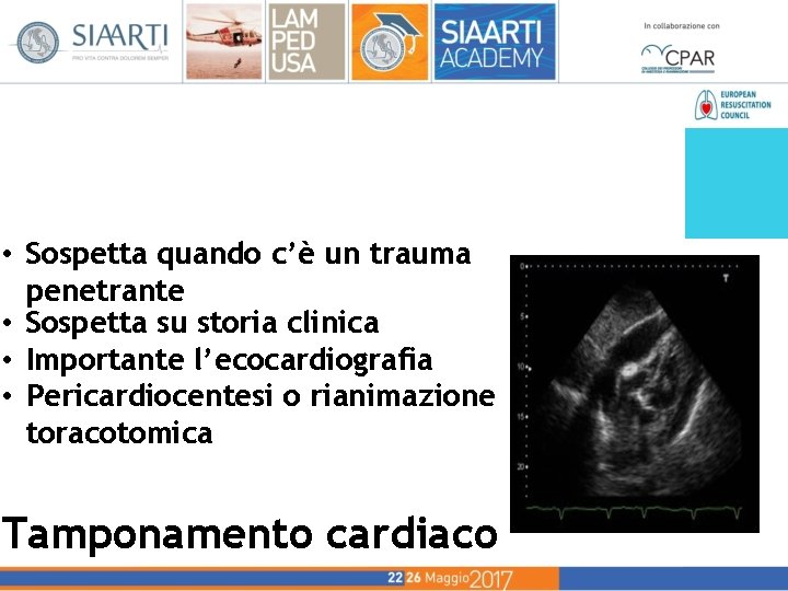 • Sospetta quando c’è un trauma penetrante • Sospetta su storia clinica • • Sospetta quando c’è un trauma penetrante • Sospetta su storia clinica •