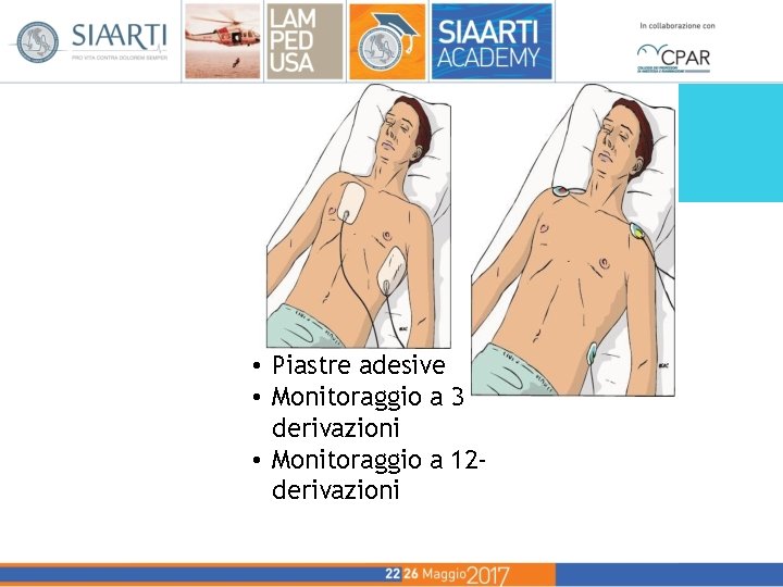 • Piastre adesive • Monitoraggio a 3 derivazioni • Monitoraggio a 12 derivazioni • Piastre adesive • Monitoraggio a 3 derivazioni • Monitoraggio a 12 derivazioni