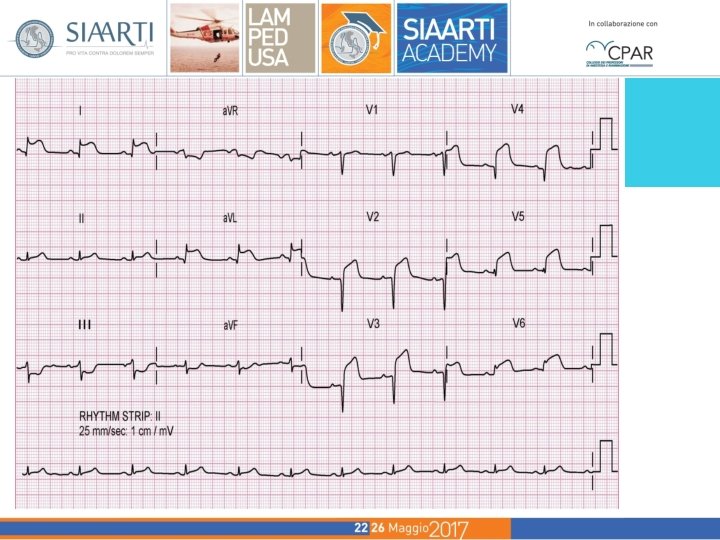 ALGORITMO ALS CIRCOSTANZE SPECIALI LETTURA ECG Algoritmo ALS