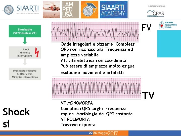 FV Onde irregolari e bizzarre Complessi QRS non riconoscibili Frequenza ed ampiezza variabile Attività FV Onde irregolari e bizzarre Complessi QRS non riconoscibili Frequenza ed ampiezza variabile Attività