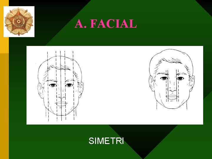 A. FACIAL SIMETRI 