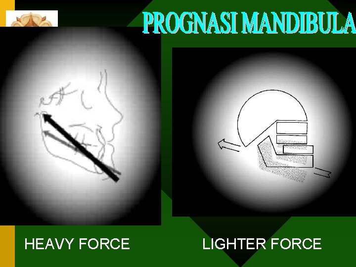 HEAVY FORCE LIGHTER FORCE 