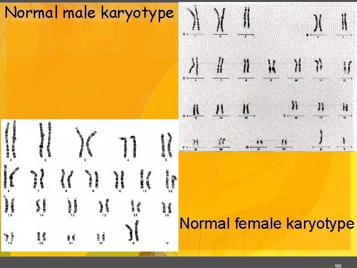 Normal male karyotype Normal female karyotype 100 