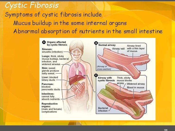 Cystic Fibrosis Symptoms of cystic fibrosis include Mucus buildup in the some internal organs