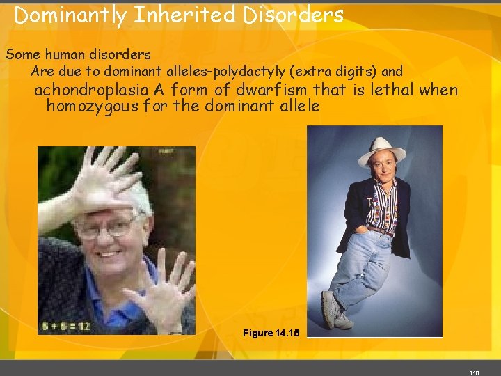 Dominantly Inherited Disorders Some human disorders Are due to dominant alleles-polydactyly (extra digits) and