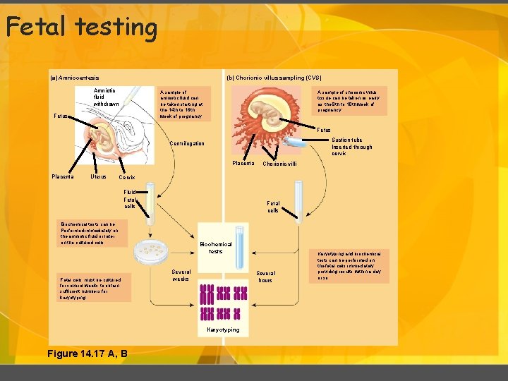 Fetal testing (b) Chorionic villus sampling (CVS) (a) Amniocentesis Amniotic fluid withdrawn A sample