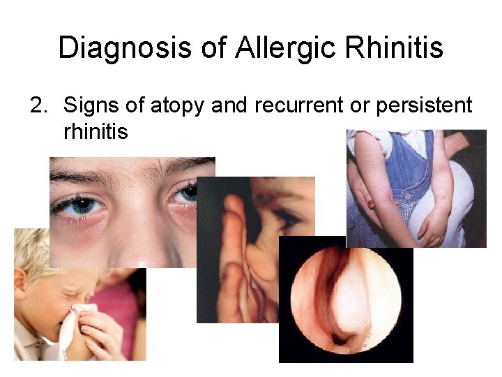 Allergic Rhinitis in Children Alfred Tam MBBSHK FRCPEdin