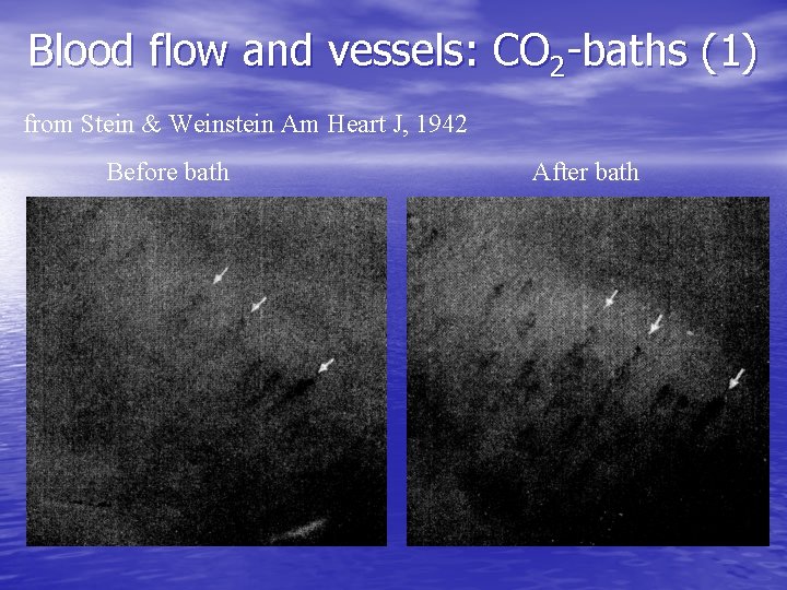 Blood flow and vessels: CO 2 -baths (1) from Stein & Weinstein Am Heart