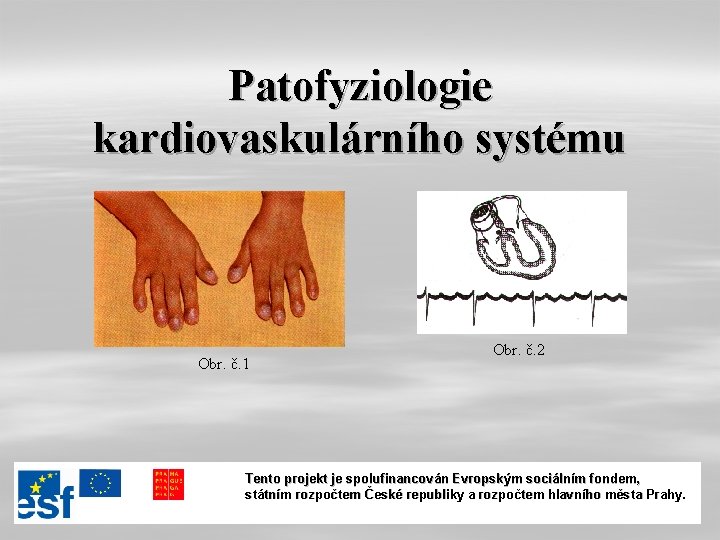 Patofyziologie kardiovaskulárního systému Obr. č. 1 Obr. č. 2 Tento projekt je spolufinancován Evropským