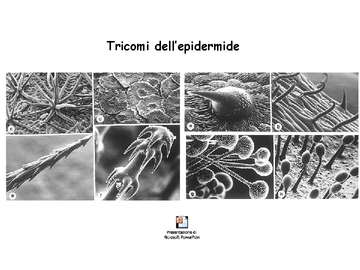 Tricomi dell’epidermide 