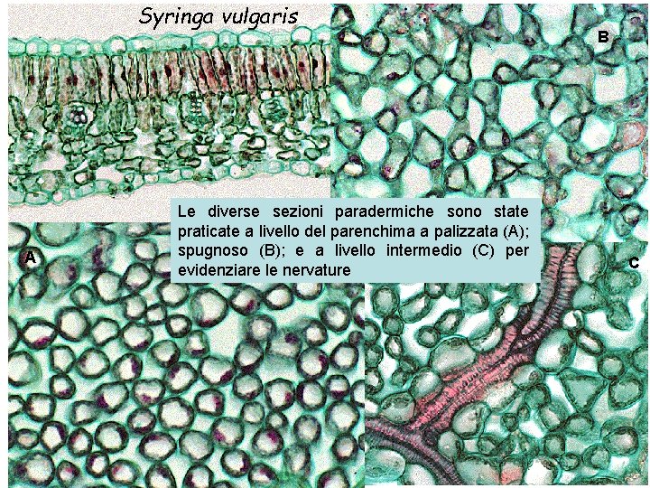 Syringa vulgaris A Le diverse sezioni paradermiche sono state praticate a livello del parenchima