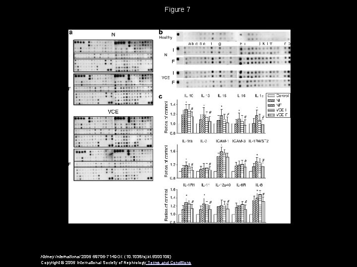 Figure 7 Kidney International 2006 69706 -714 DOI: (10. 1038/sj. ki. 5000109) Copyright ©