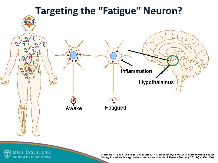 Targeting the “Fatigue” Neuron? Inflammation Hypothalamus Awake Fatigued Grossberg AJ, Zhu X, Leinninger GM,