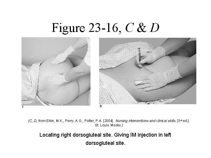 Figure 23 -16, C & D (C, D, from Elkin, M. K. , Perry, Figure 23 -16, C & D (C, D, from Elkin, M. K. , Perry,