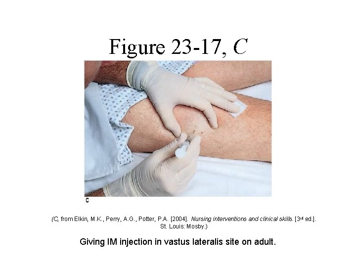 Figure 23 -17, C (C, from Elkin, M. K. , Perry, A. G. , Figure 23 -17, C (C, from Elkin, M. K. , Perry, A. G. ,