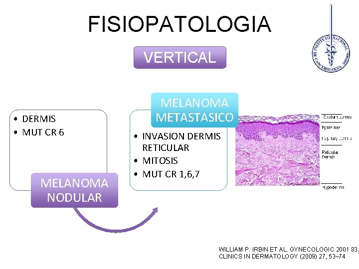 FISIOPATOLOGIA VERTICAL • DERMIS • MUT CR 6 MELANOMA NODULAR MELANOMA METASTASICO • INVASION