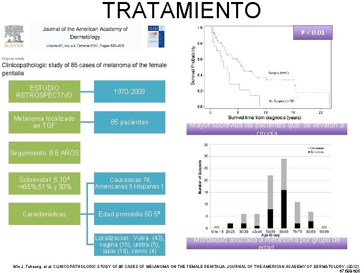 TRATAMIENTO P < 0. 01 ESTUDIO RETROSPECTIVO 1970 -2009 Melanoma localizado en TGF 85