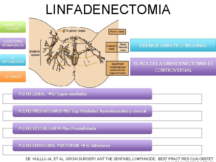 LINFADENECTOMIA CUERPO DEL CLÍTORIS COLECTORES INFRAPÚBICOS DRENAJE LINFATICO INGUINAL GL OBTURADORES EL ROL DEL