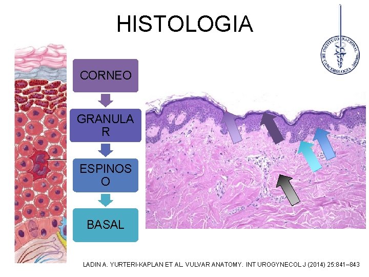 HISTOLOGIA CORNEO GRANULA R ESPINOS O BASAL LADIN A. YURTERI-KAPLAN ET AL. VULVAR ANATOMY.