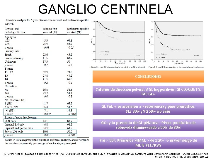 GANGLIO CENTINELA CONCLUSIONES Criterios de disección pélvica: 3 GL Ing positivos, Gl CLOQUET´S, TAC