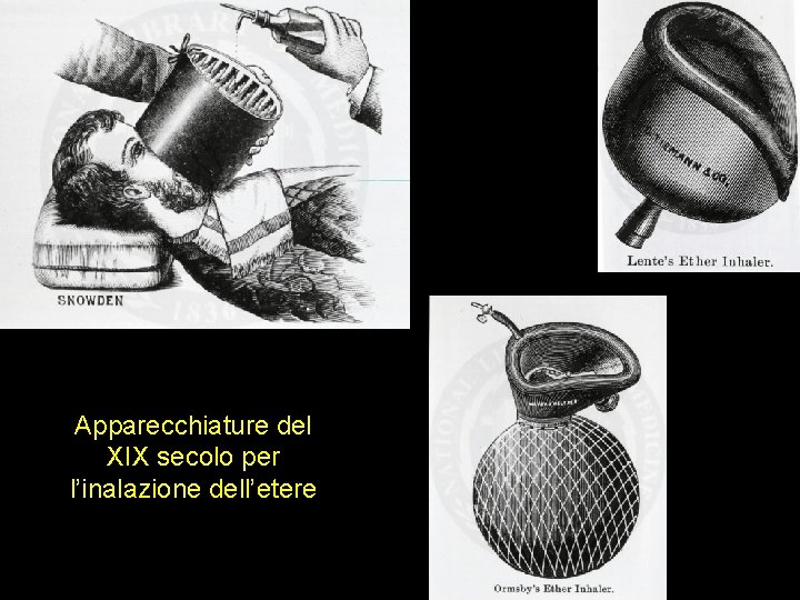 Apparecchiature del XIX secolo per l’inalazione dell’etere 