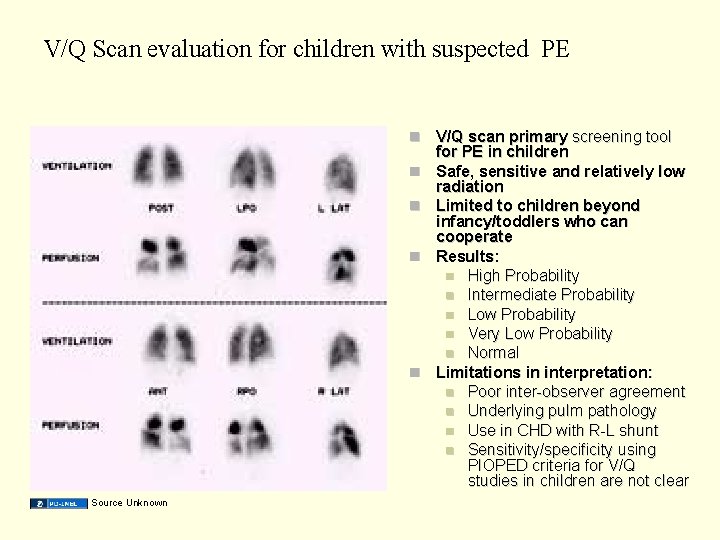 V/Q Scan evaluation for children with suspected PE Source Unknown V/Q scan primary screening