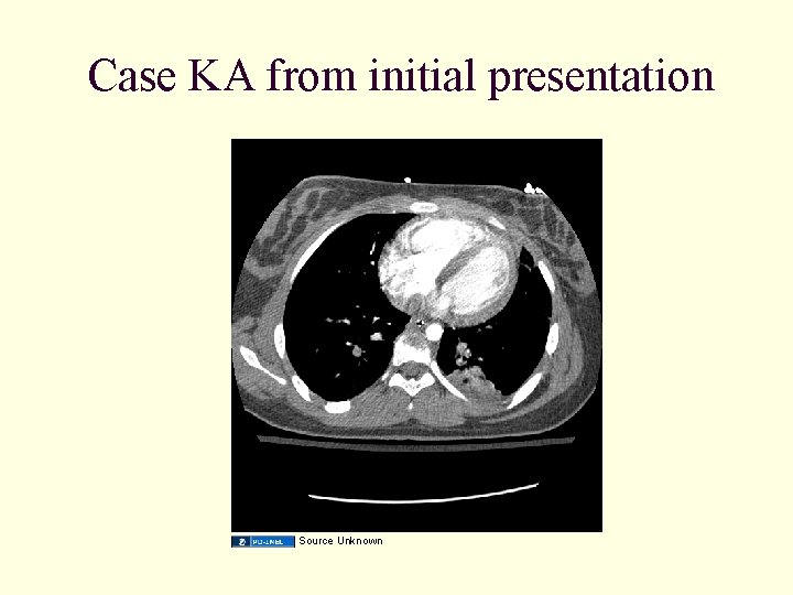 Case KA from initial presentation Source Unknown 