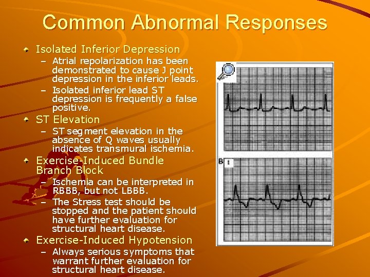 Common Abnormal Responses Isolated Inferior Depression – Atrial repolarization has been demonstrated to cause