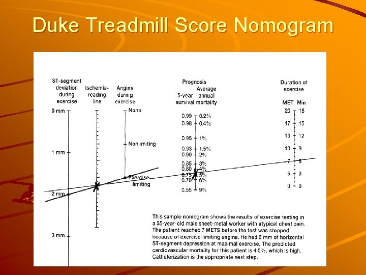 Duke Treadmill Score Nomogram 