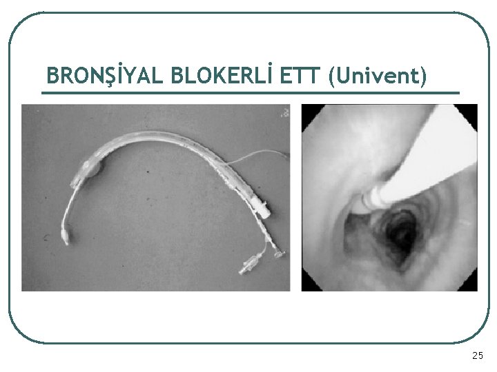 BRONŞİYAL BLOKERLİ ETT (Univent) 25 